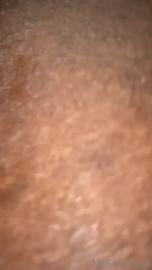 8010878