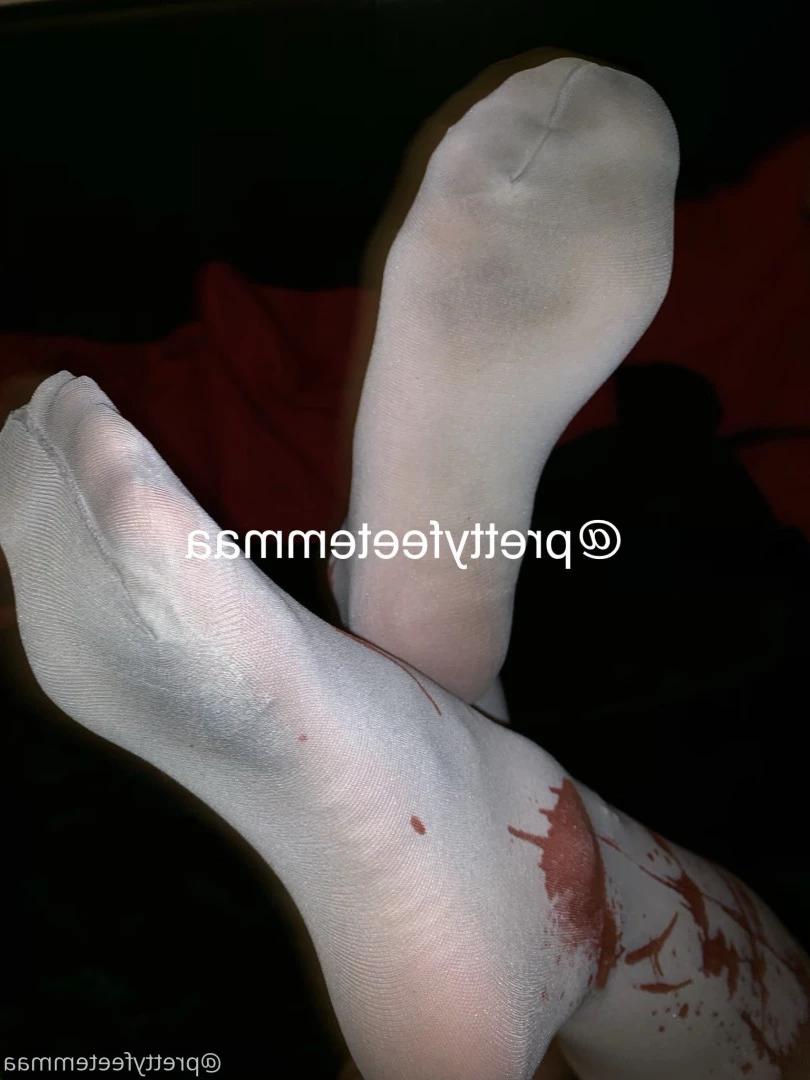 prettyfeetemmaa Onlyfans leaked photo 9230806 on Hotleaks.tv