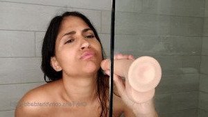 7945618