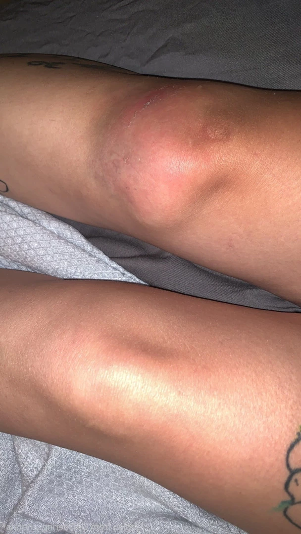 Lexi - Toe Rings and Tattoos [ toeringsandtats ] Onlyfans leaked photo 8769397 on Hotleaks.tv