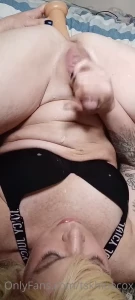 7929581