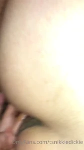 7929170