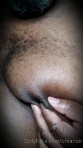 7922557