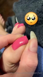 7913883