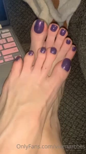 7913967