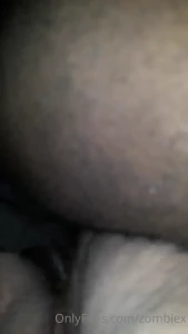 7904395