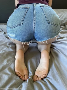 15625415
