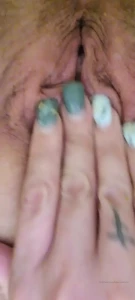10488739