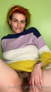 14176183
