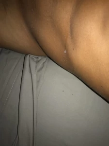 15770840