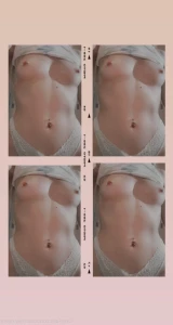 16147738