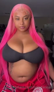 10381752