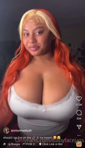 10381754
