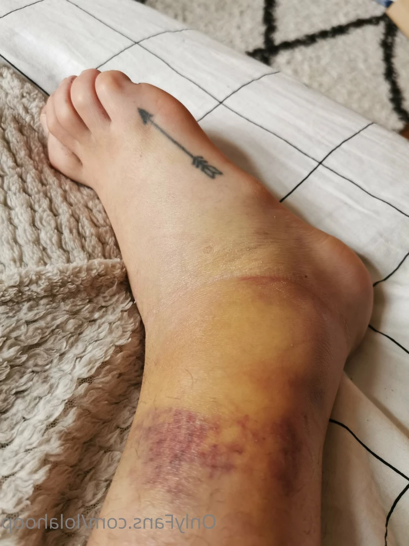 Lola Hoop (LustLouise) [ lolahoop ] Onlyfans leaked photo 8361526 on Hotleaks.tv