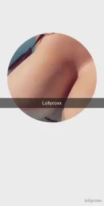 18189864