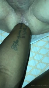10179504
