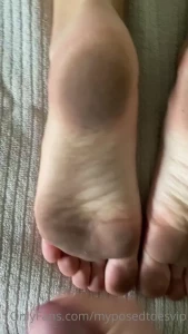 15878854