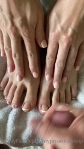 15878877