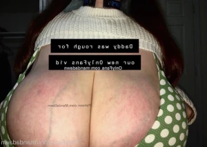 6232689