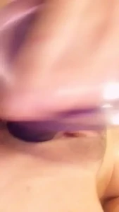 10079228