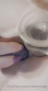18178123