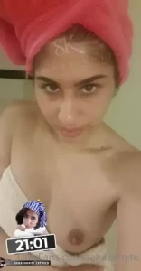 18174204