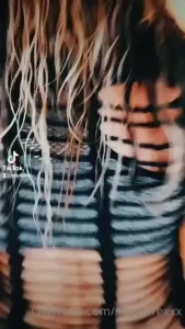 18170931