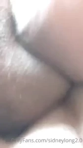 18170889