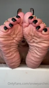 9958857