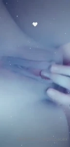 9945776