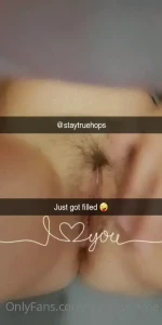 9938915