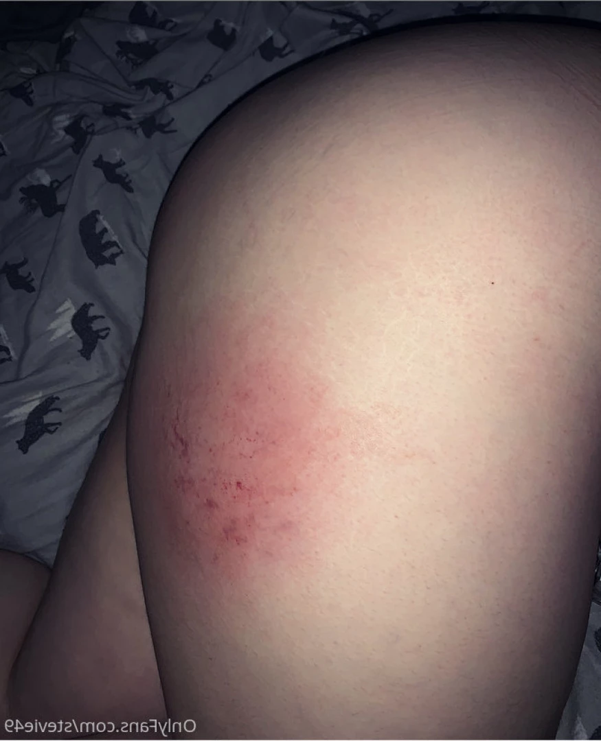 Stevie 💕 [ steview49 ] Onlyfans leaked photo 8284070 on Hotleaks.tv