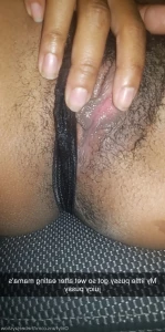 8086800