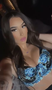 15159148