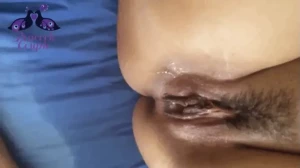 18163161