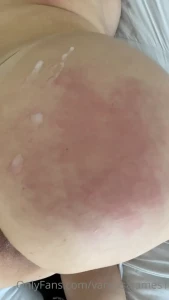 9833826