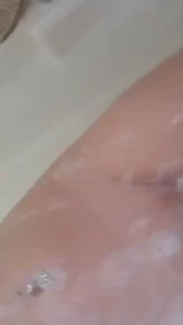 18158771