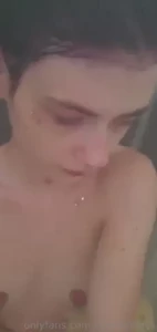 18158777