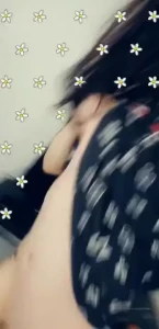 18158781