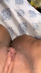 9795396