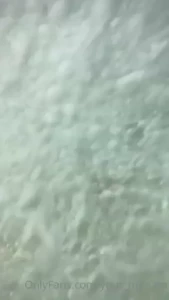 18157520