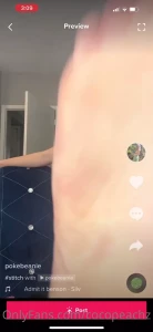 15099228