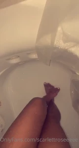 16415878