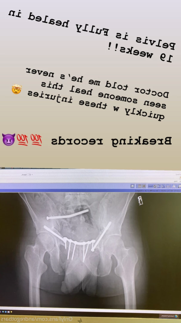 Andy Savage [ andregotbars ] Onlyfans leaked photo 12026415 on Hotleaks.tv
