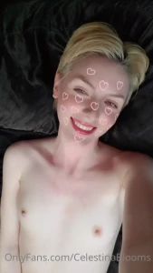 15861778