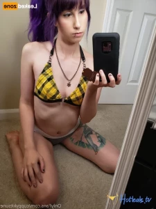 15633420