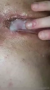 18156082