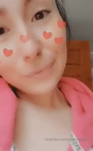 18154570