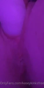 18145729