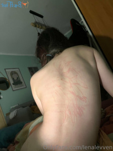 17230164